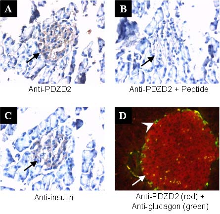 PDZD2 immunostaining